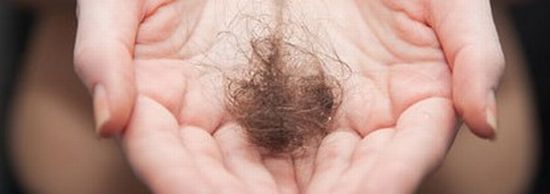 男性の円形脱毛症の症状画像
